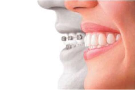 Improve Your Oral Health with Magic Dental Torrance: The Ultimate Solution